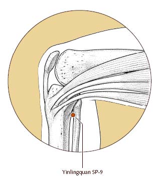 Pain Relief by Saratoga Springs Acupuncturists Danielle DeVivo 7_Fast_Ways_to_Stop_a_Headache_without_Drugs_img_2